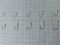 Набір гачків - Розміри 3-12 - 500 шт/уп - Золото